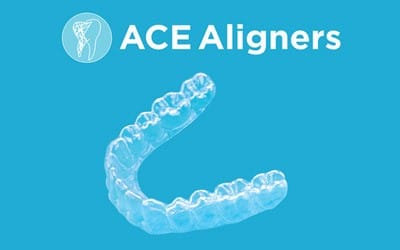 Ace Clear Aligners To Straighten Teeth