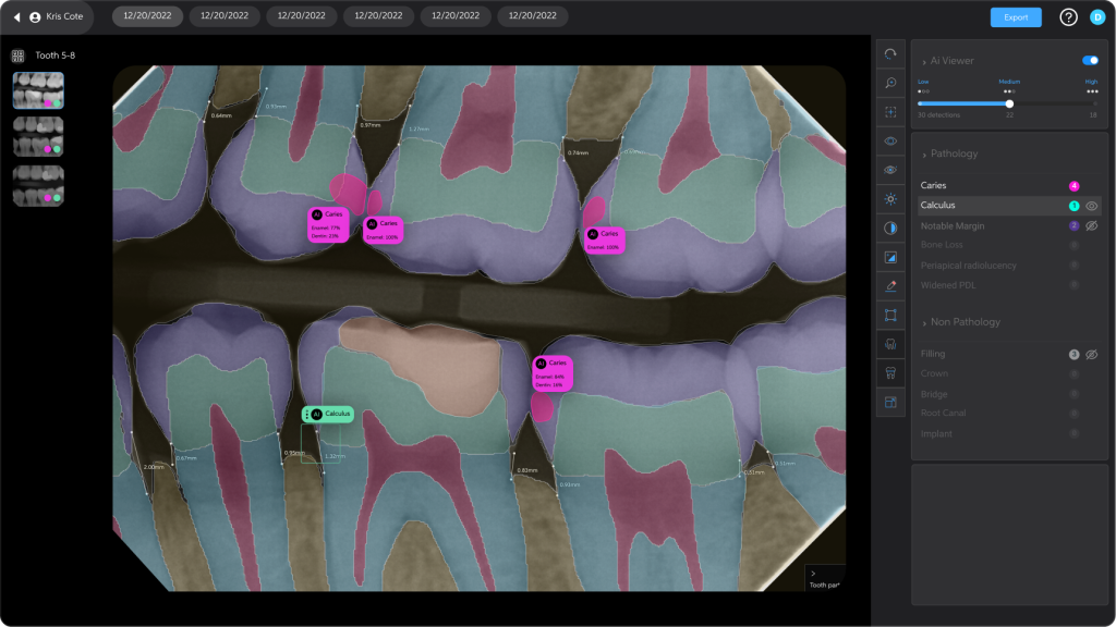 Ai Diagnostics for Dentistry